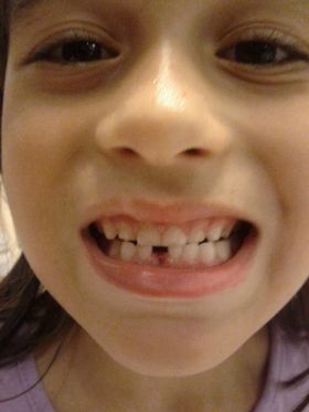 Elcira Maimonte's daughter's tooth comes out, Chitre, Panama – Best Places In The World To Retire – International Living